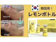 パリス 七尾店の雰囲気（韓国発の最新技術★レモンボトルで脂肪にアプローチ）