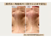 ルアナ 柏店(LUANA)