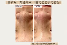 ルアナ 柏店(LUANA)