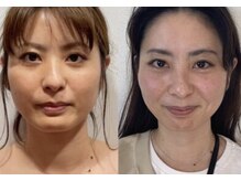 ジーニー(genie)/1年前→現在 