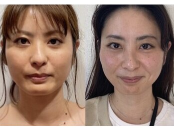 ジーニー(genie)/1年前→現在