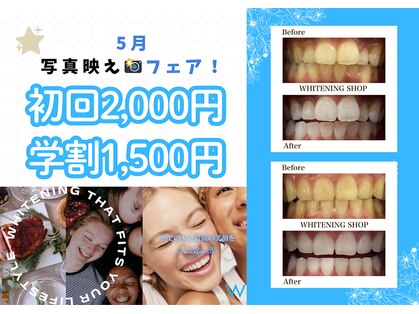 ホワイトニングショップ 川越店の写真