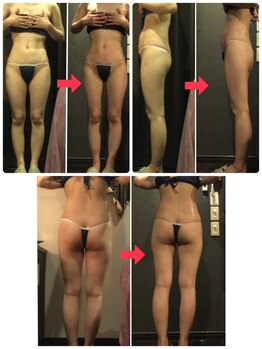 プラチナアース つくば店(Platinum earth)/痩身ビフォーアフター