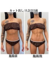 ヴィーナス(Venus)/スタッフ施術/上半身カット出し