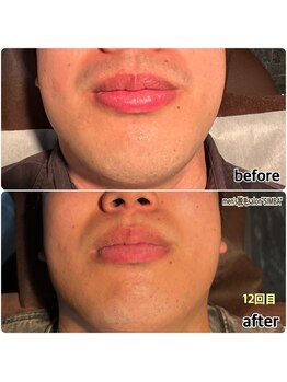 シンバ 倉敷店(SIMBA)/