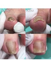 巻き爪補正店 鎌倉大船店/