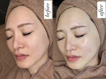 ベルーテ 田町三田(Bellute)/ちゅるんと輝く美肌エステ♪