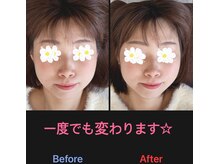 美容矯正サロン レレポノ(LELEPONO)/一度でも変わります。