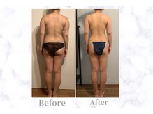 ふじこのきもち/20代後半(バスト&バンテージ)