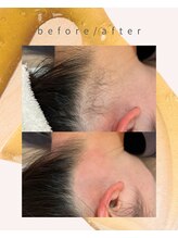 ウララカ(uraraca)/実は見られているうなじ