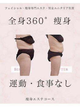 ユニクリア(Uni clear)/佐賀市ユニクリア・痩身エステ