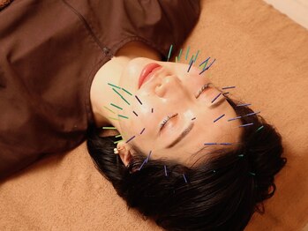 アキュシア鍼灸院(ACUSiA)/