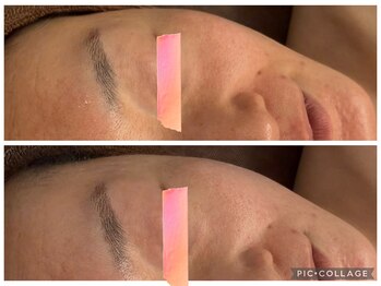 イディアル(IDE'AL)/お試しハーブ＋ビタミン＊