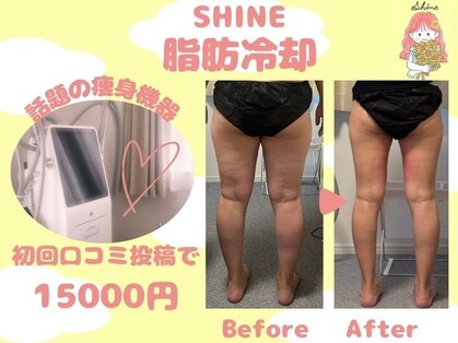 シャイン(SHINE)の写真