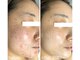 ナチュラリー 佐賀(Naturally)の写真