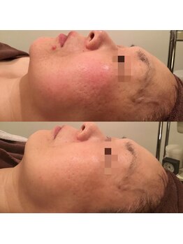 アルファイン マテリアル店/VOSビフォーアフター