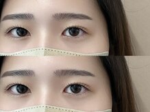 ミーアイラッシュ(ME.eyelash)/LASH LIFT