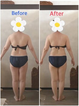 ソレイユ/インディバで根本改善