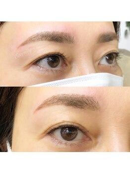 エタニティ(eternity)/美眉デザイン(眉毛+おでこ)