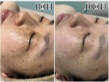 ビーカーブス 三鷹(B.curves)/before・after