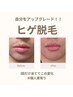 【メンズヒゲ脱毛】メンズも脱毛の時代！清潔感のある男性に！¥3300→¥1650