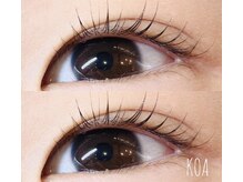 コア バイグーフィー(KOA by GOOFY)