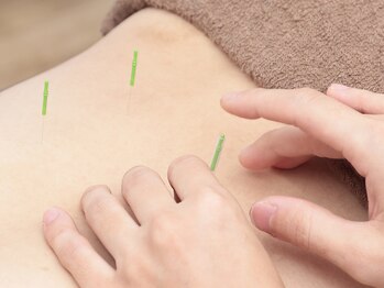 了鍼灸整骨院/腰痛、肩こり、自律神経の乱れ