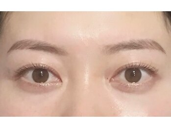 リボン(RiboN)の写真/バレンタイン前に「目元美人コース」を自分へプレゼント♪この冬、鏡を見るたびにときめく自分を！