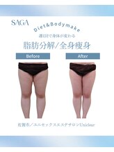 ユニクリア(Uni clear)/佐賀市│人気の痩身エステ