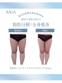 ユニクリア(Uni clear)/佐賀市│人気の痩身エステ