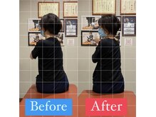 ナオル整体 宮崎院(NAORU整体)/50代女性施術事例【体幹回旋痛】
