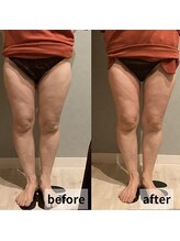 セイリキ(SEIRIKI)/★痩身ダイエットお客様のお声★