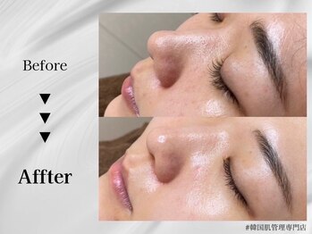 ホワイトラボ 梅田(White labo)/韓国ツヤ美肌☆オルチャン肌に♪