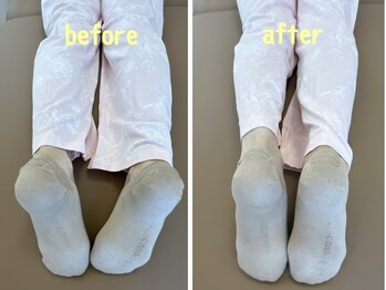 リノ25(LINO25)/不調知らずの身体作り◎