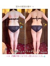 花音/骨盤の歪みは太りやすい体質へ