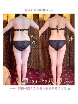 花音/骨盤の歪みは太りやすい体質へ