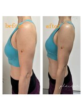 プレジールサロン(plaisir salon)/◇下腹・バストアップに効果的◇