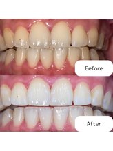 リ ホワイト(Re.White)/