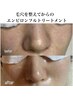 リピーター様◎リピNo.1【1ランク上の美肌】毛穴ピール＋エンビロンフルTR