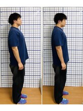 幸鍼灸整体院 武庫之荘院/整体・トレーニング・姿勢変化8