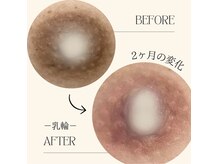 サロンドリシェス(Salon de RICHESSE)の雰囲気(ローマピンクで黒ずみ悩みを1度の施術で改善!満足度の高い施術!)