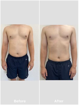 ウィータ とうの鍼灸整骨院(vita)/ダイエット