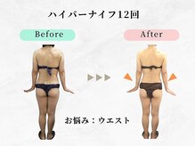 美容整体ウェリナ あま甚目寺院/小顔矯正/骨盤矯正/美脚サロン