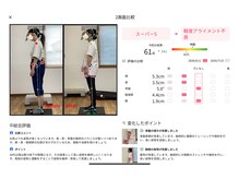 ティーシー(TC)/1月前と今、姿勢変化(側面) 評価