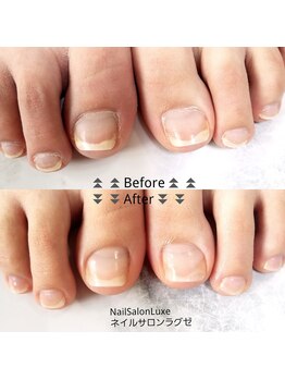 ネイル サロン ラグゼ(Nail Salon Luxe)/【フット】贅沢ケアコース8800円