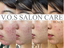 ルーナ(Runa)/■ＶＯＳサロンケア【ブラック】