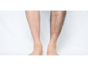 ディライト 名古屋駅店(Delight)/足のメンズ脱毛　ゴルフ好きに