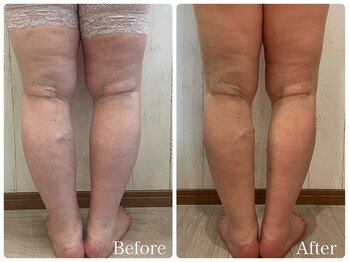 サロン ブーケ(Salon Bouquet)/健康的にむくみを退治！