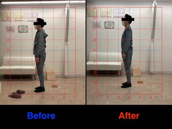 整体院 仁(JIN)/#デスクワーク#眼圧#猫背#首こり