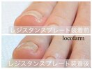 巻き爪改善ケア